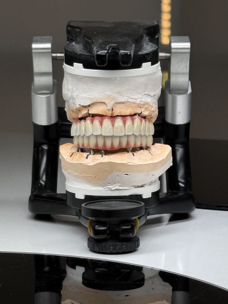 Artikülatör üzerinde gerçekçi diş modeli, diş laboratuvarı gösterileri için idealdir.